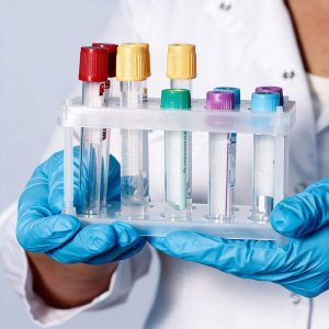 Какие анализы сдать в конце зимы в Ставрополе: чек лист для всей семьи